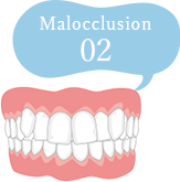 不正咬合の種類 インビザラインで矯正可能な歯並び 熊本パール総合歯科クリニック